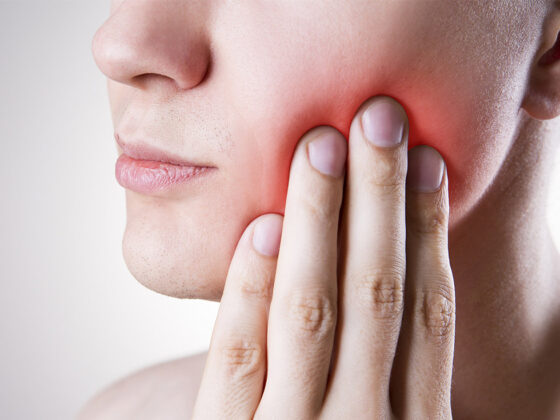 Lucariello Odontoiatria - Paradontite