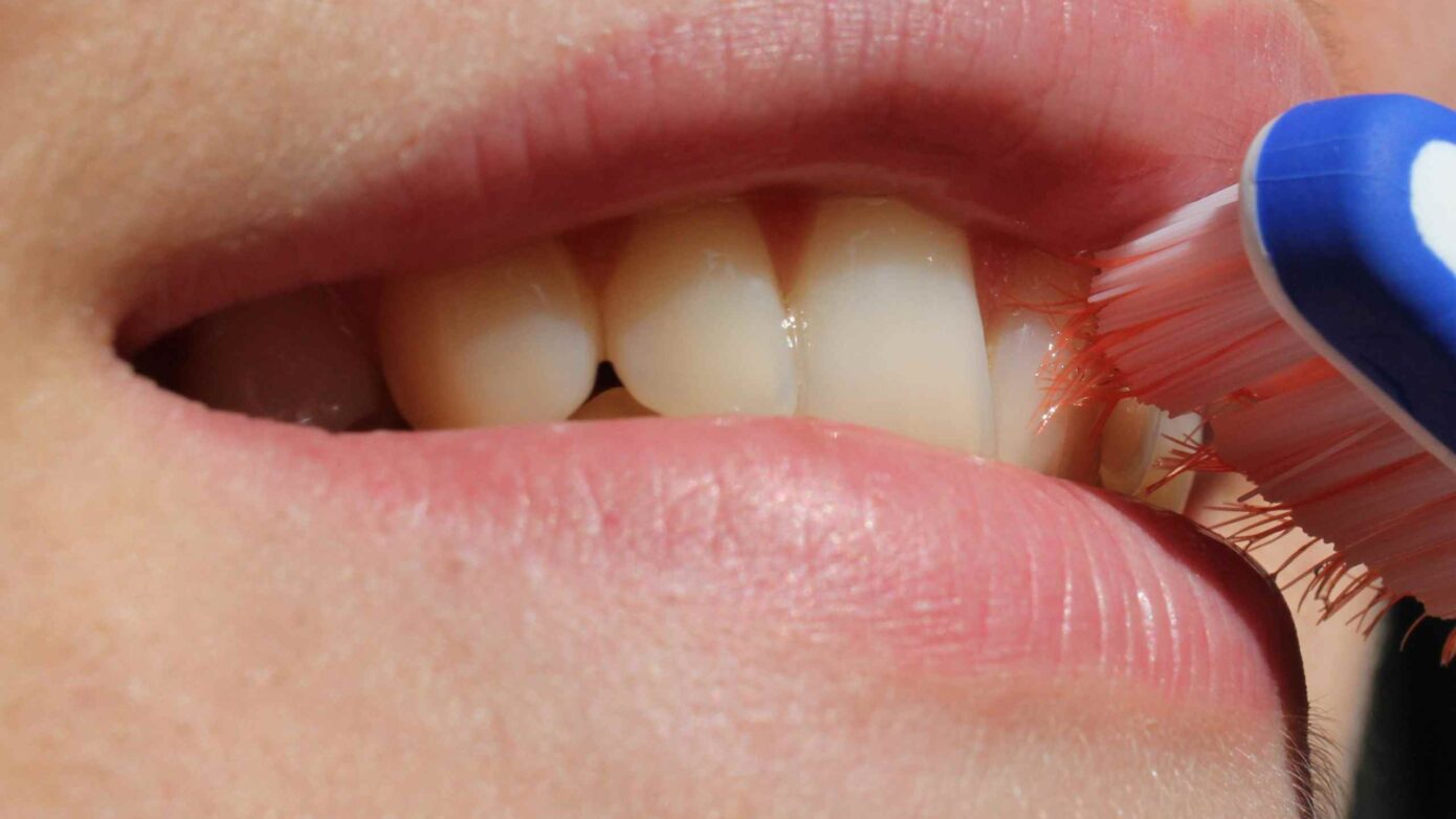 Lucariello Odontoiatria - Denti gialli bambini